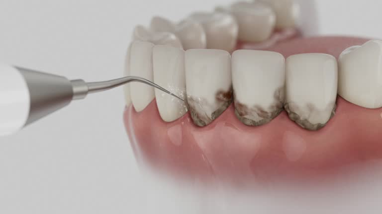 Reliable Dental Implants contractor in Sand Point, AK by Smile Center Dentistry